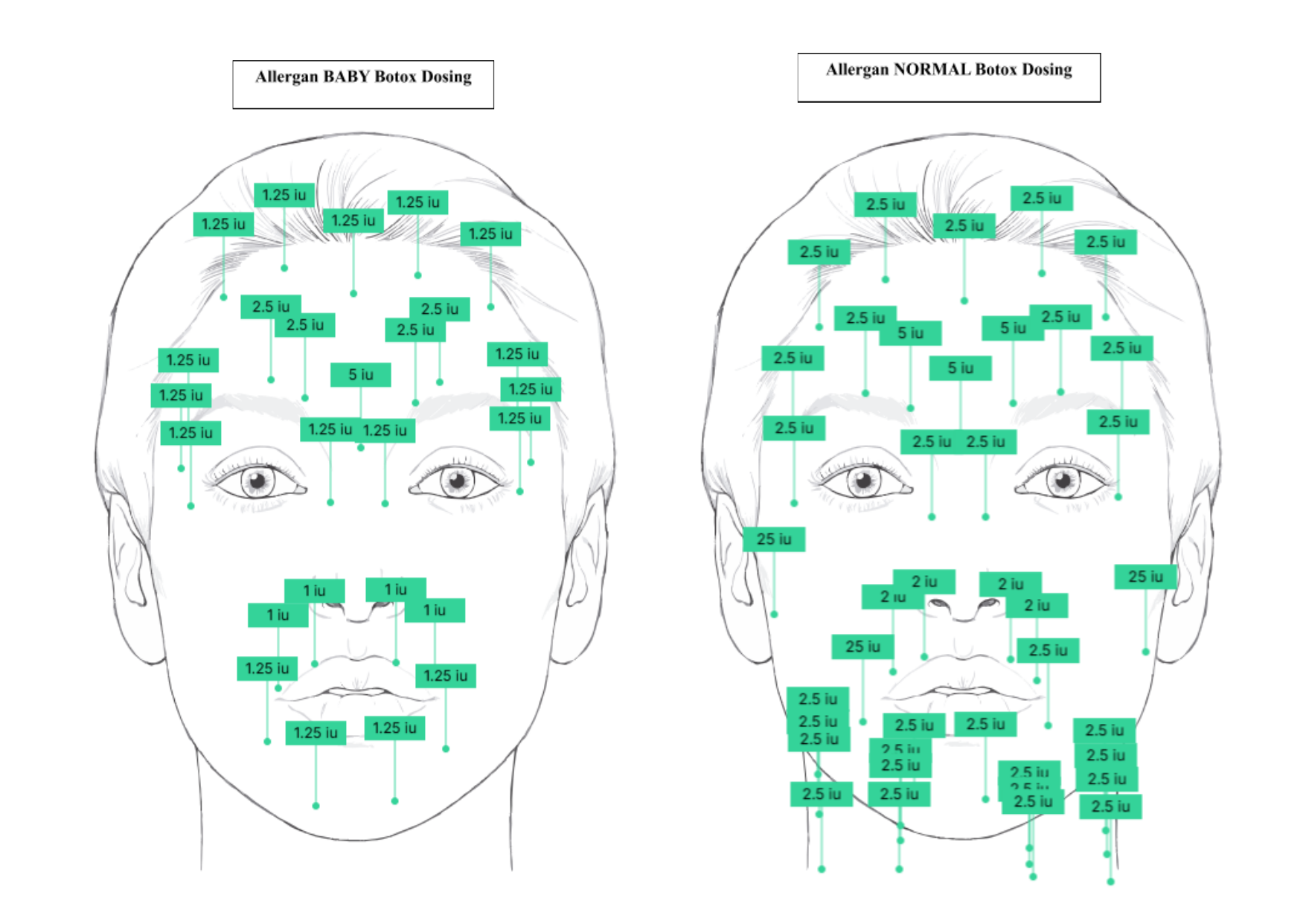 Allergan Botox dosing chart, baby and normal